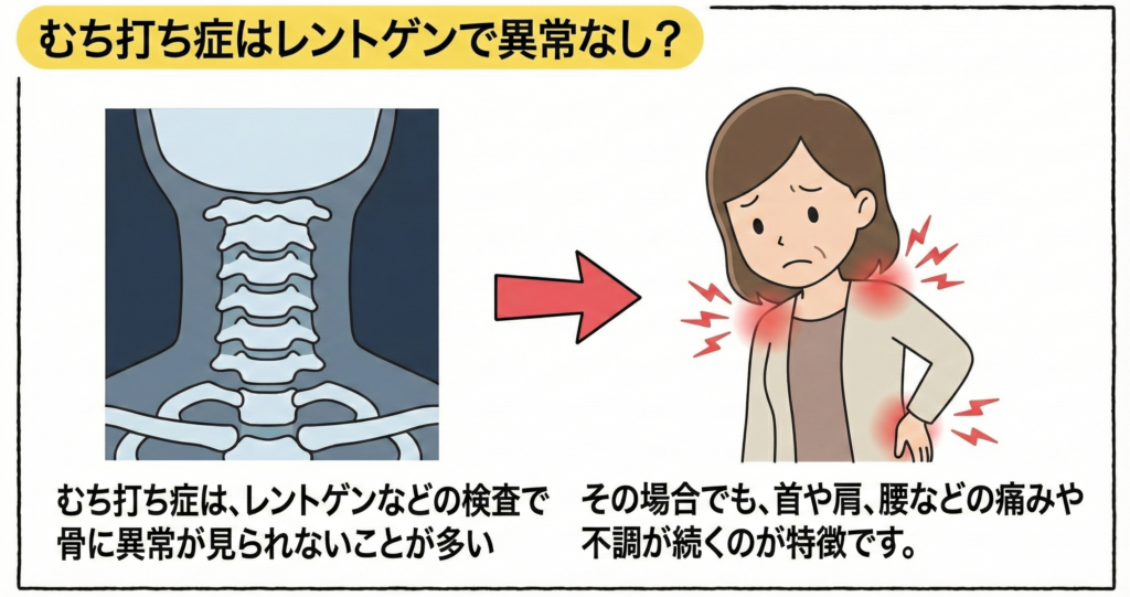 レントゲン異常なし