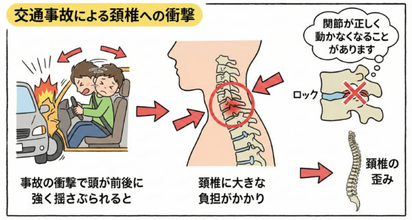 交通事故によるダメージ