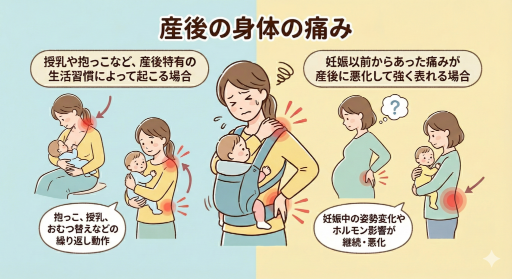 産後の痛み